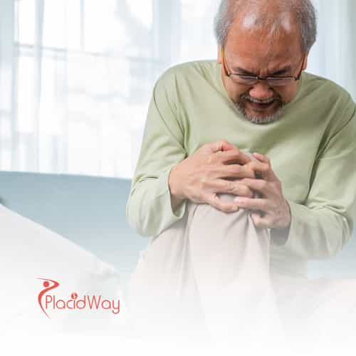 Stem Cell Therapy for Osteoarthritis in Germany: Advanced Treatment for UK Patients from London